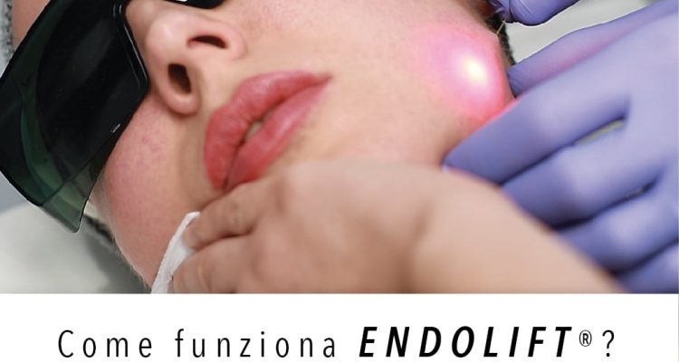 ENDOLIFT® è un trattamento per il ringiovanimento ed il rimodellamento laser assistito senza bisturi, segni e senza sofferenza.