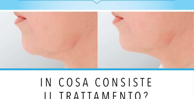 ENDOLIFT®: in cosa consiste il trattamento?